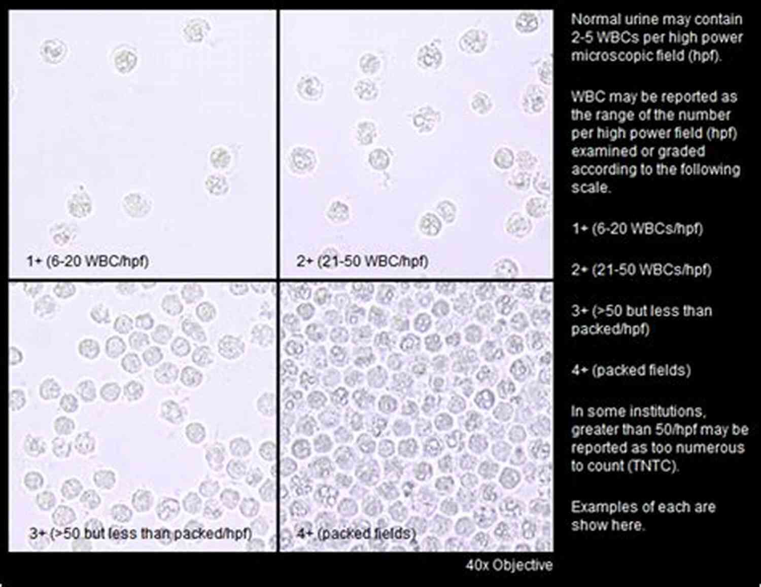 Blood Cell Count Ten Graphs For The Amateur Microscopist: A Brief Exploration Of Your First Microscope Experiences